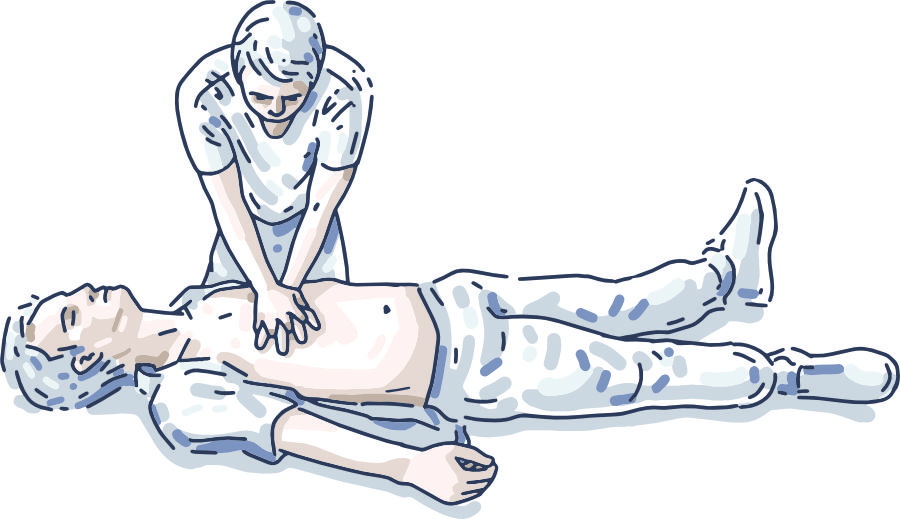 Bröstkompresioner på vuxen 